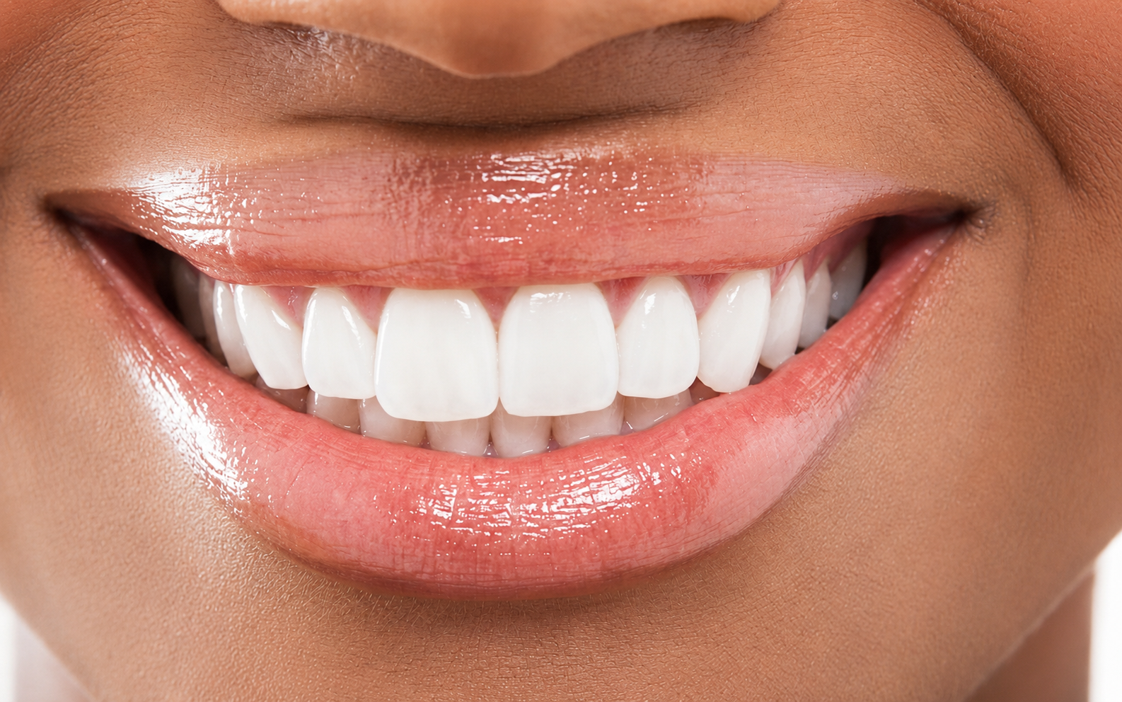 Sorriso depois do tratamento - Caso 1